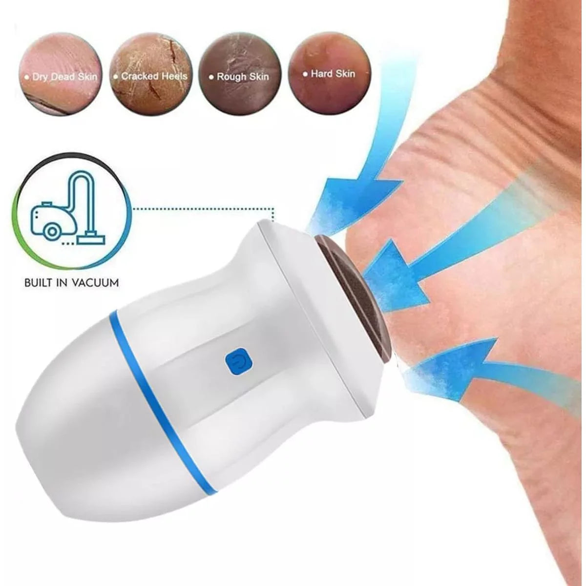 Foot Callus Remover Vacuum - Smooth and Healthy Feet - Rechargeable