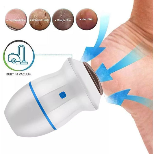 Foot Callus Remover Vacuum - Smooth and Healthy Feet - Rechargeable